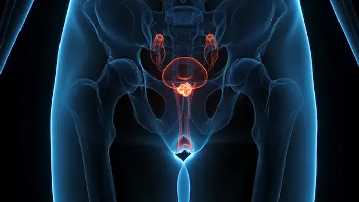 Cervical Cancer Screening Frequency: Causes, Tests, and Prevention